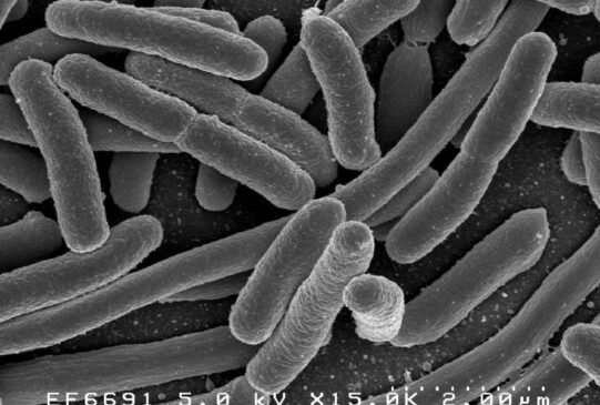 Read more about the article E. Coli Outbreak in England: One Death Reported and 275 Confirmed Cases