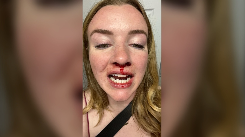 Lesbian Couple Brutally Attacked by Mob in Halifax During Pride Month Celebration