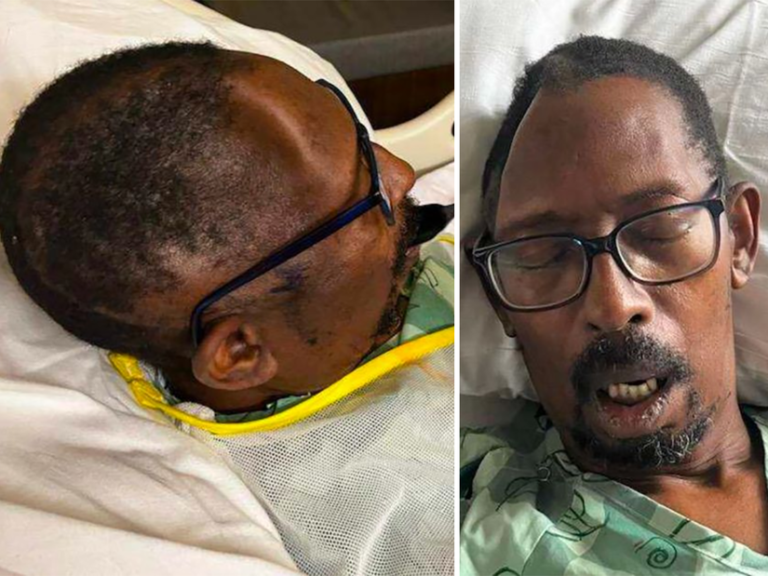 Georgia Man Sues Hospital After Alleged Loss of Skull Portion and Infection from Synthetic Replacement