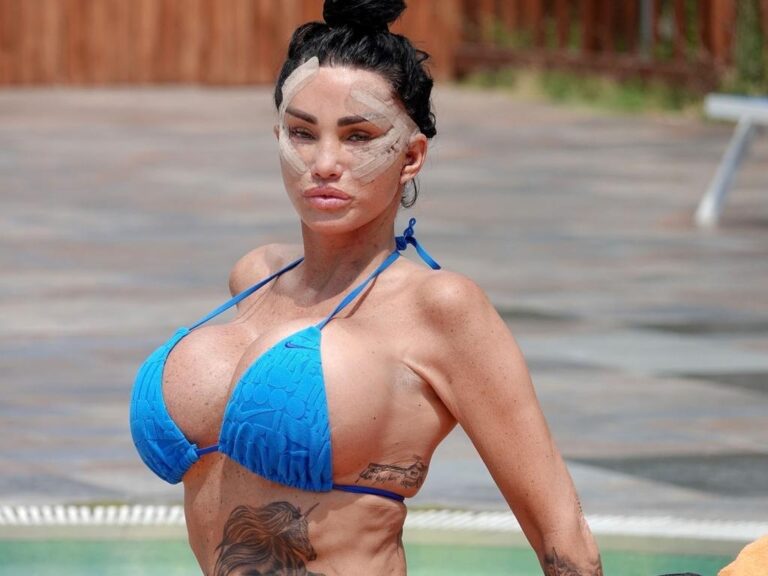 Katie Price Faces Backlash for Poolside Recovery Post-Facelift Amid Legal Troubles